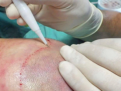 Best place of true splander