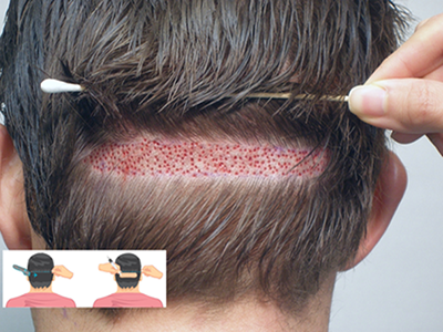 Best place of true splander